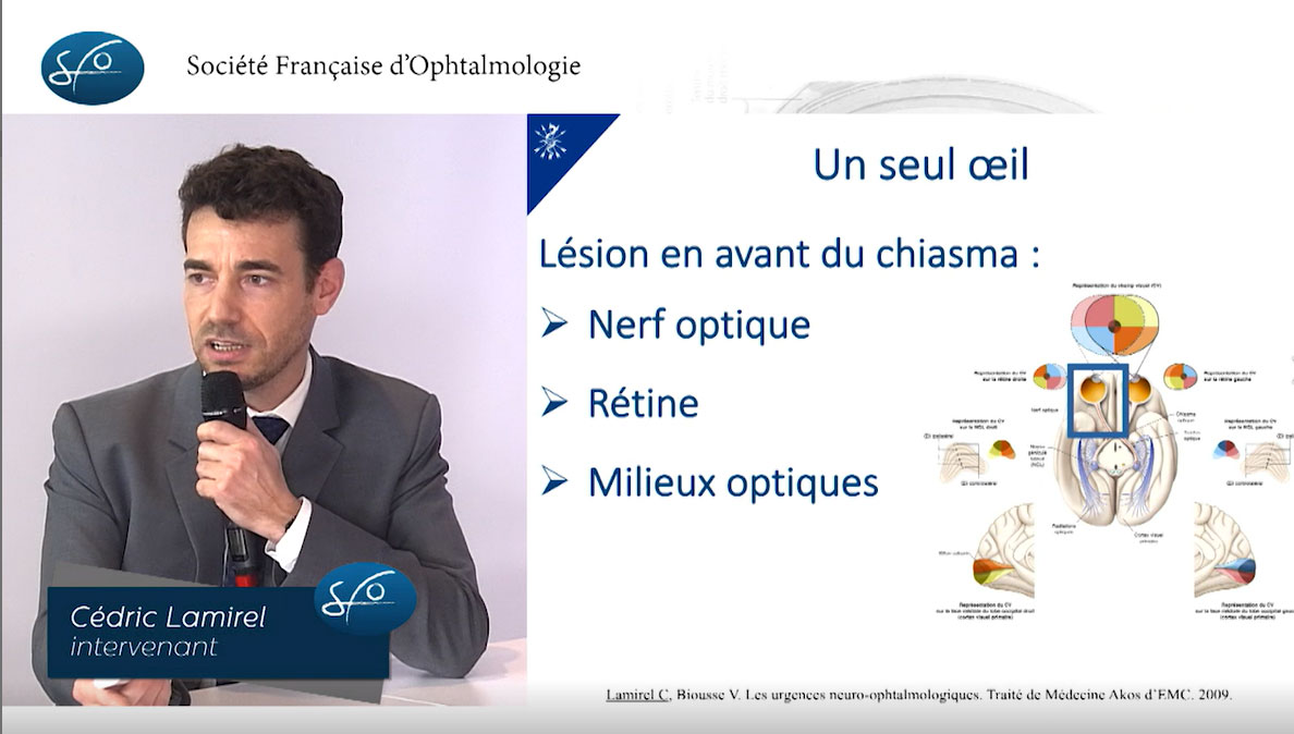 Neuro-Ophtalmologie : Cédric Lamirel