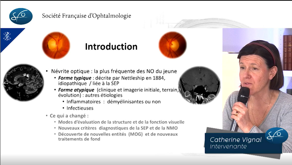 Neuro-Ophtalmologie : Catherine Vignal